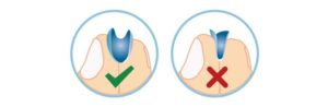 Handling Contact Lenses