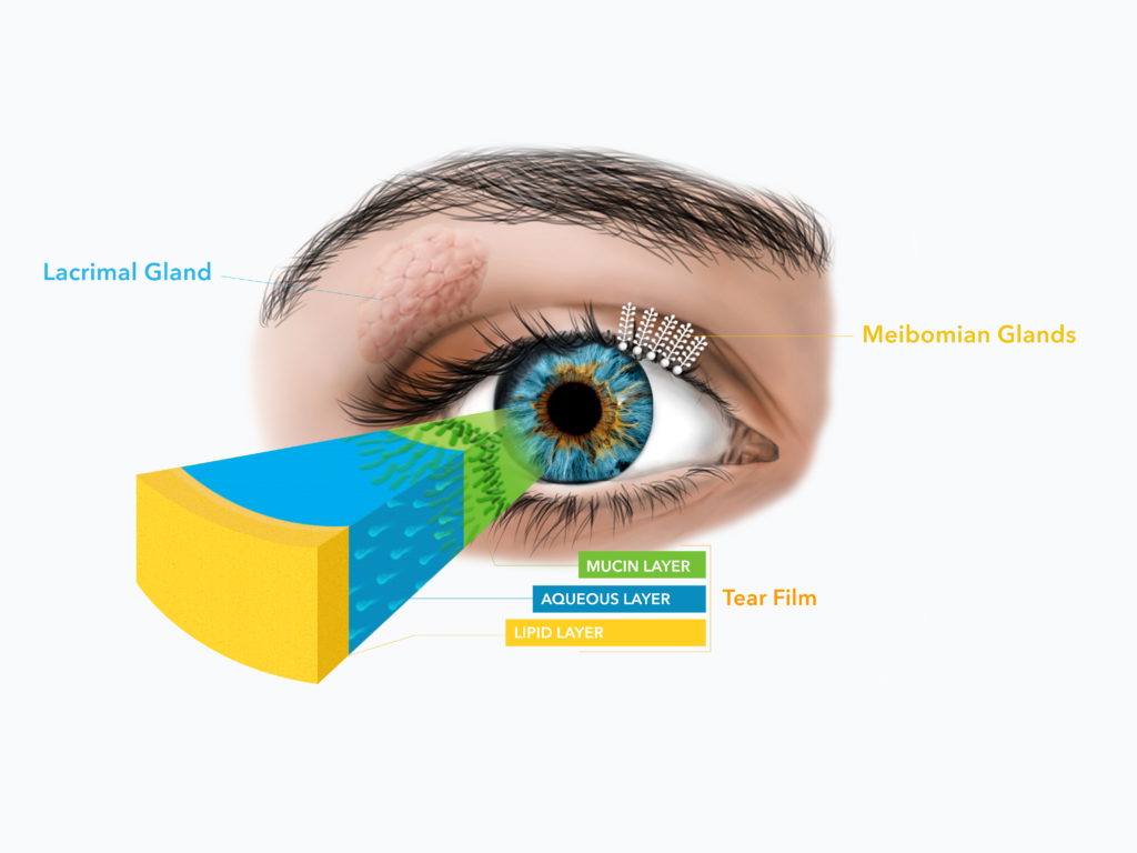 Dry Eye Diagram